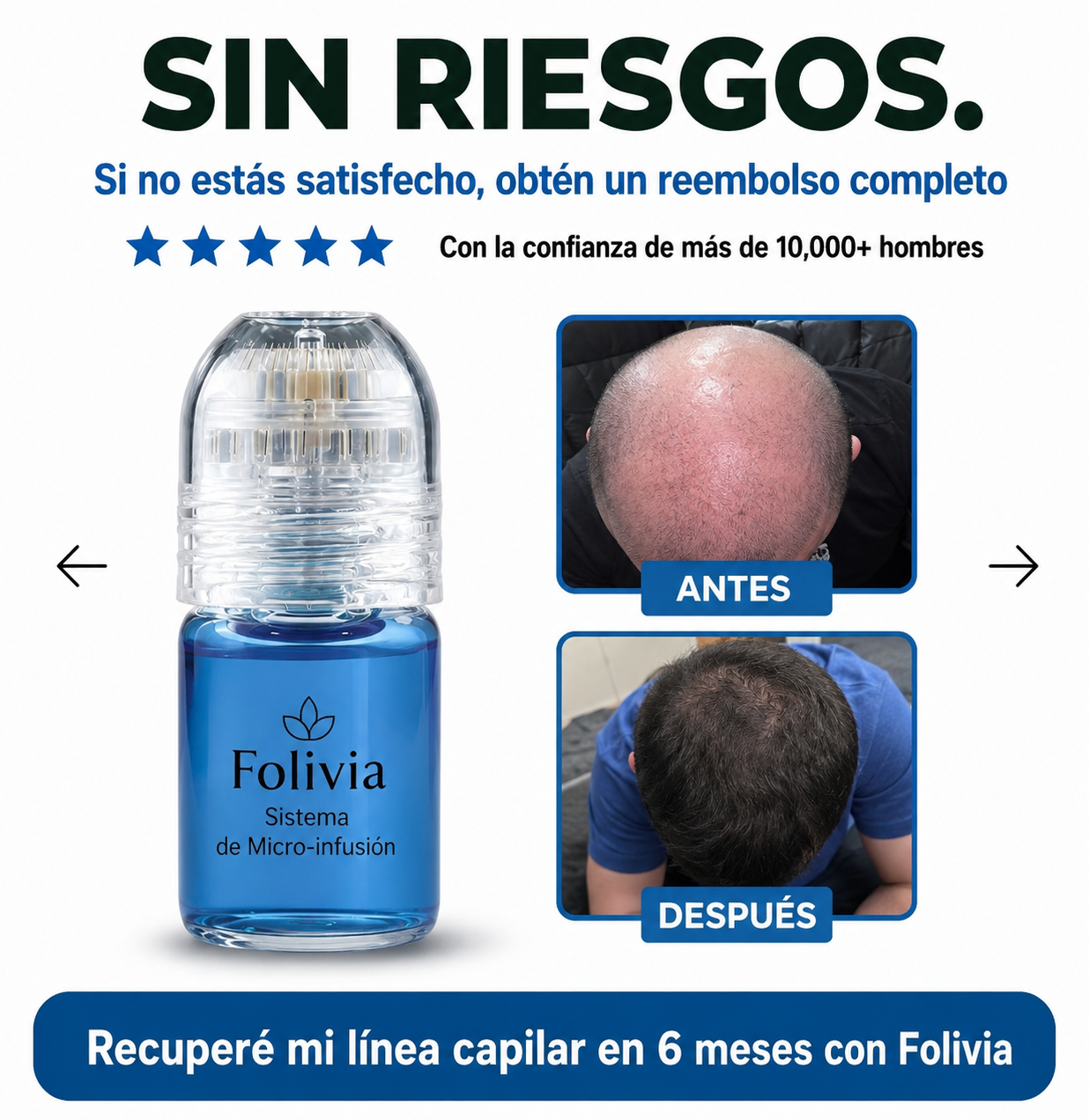 Folivia™ | Capillary Micro-Infusion Technology