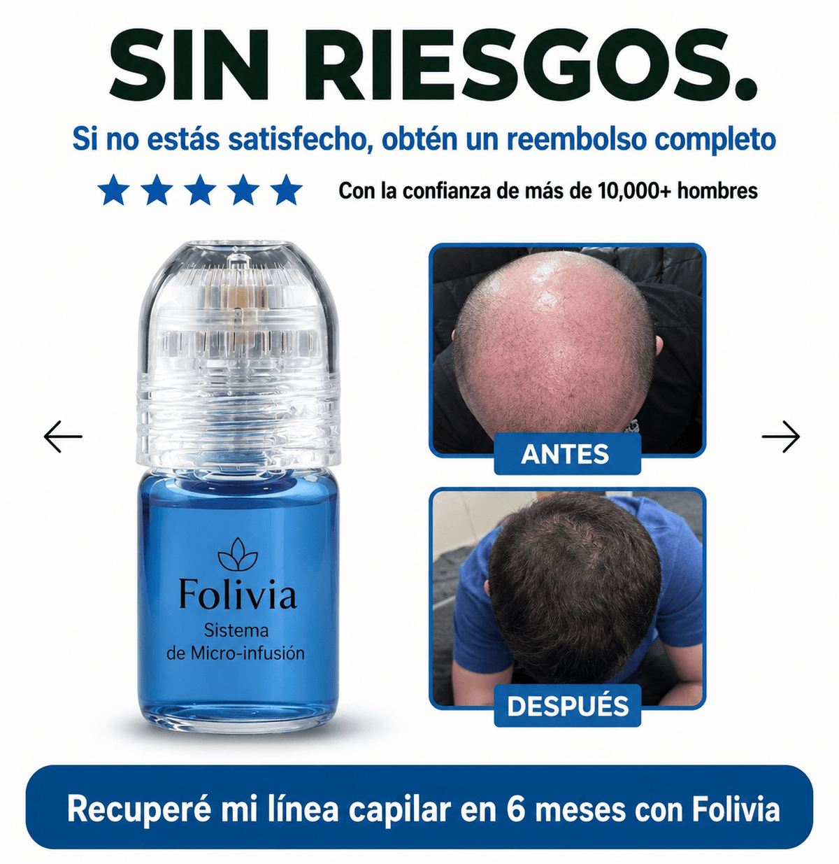photo7_of_the_Folivia_microinfusion_system